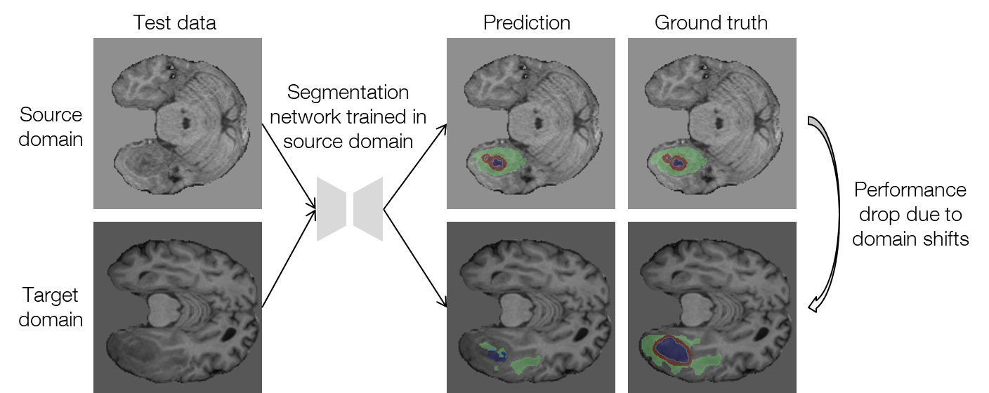 Test-time adaptation for brain tumor segmentation with cross-institutional MRI