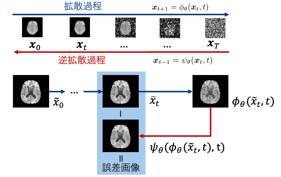 医用画像生成モデルの訓練に用いたプライバシー情報を識別するメンバーシップ推論攻撃手法の開発